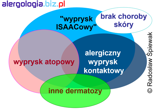 Nie da się odróżnić wyprysku atopowego od alergicznego wyprysku kontaktowego oraz innych chorób skóry za pomocą kwestionariusza ISAAC